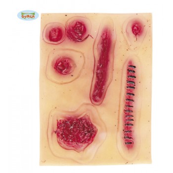 BLISTER 6 CICATRICES